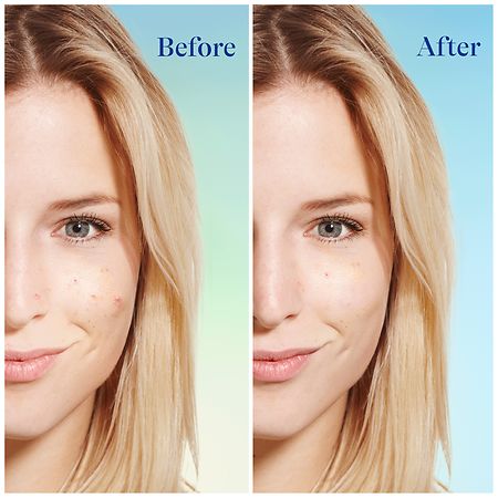 Differin Daily Deep Cleanser, 4.0 Fl Oz